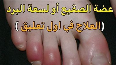  الأصابع في الشتاء.. أسبابه وطرق علاجه          