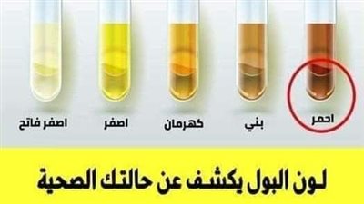 لون البول يكشف حالتك الصحية.. وهذا اللون خطېر احذر منه!
