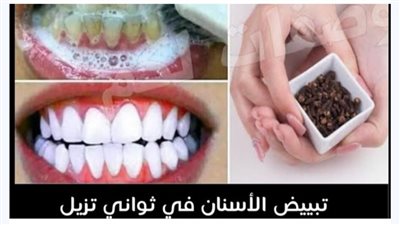تبييض الأسنان في دقيقتين فقط - يجـلب الاصــفرار والجـير المترسب أبيض حليـبي ومشرق