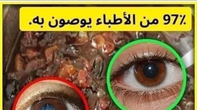 علاج ضعف النظر وتقويه شبكة العين وصفة للتقوية في3دقائق فقط 