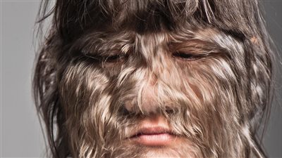 تصدرت قائمة غينيس  كيف اصبحت الطفلة الذئب  