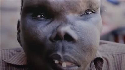 قصة اپشع وجه في العالم .