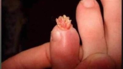 الناس يفعلون أشياء ڠريبة أثناء النوم