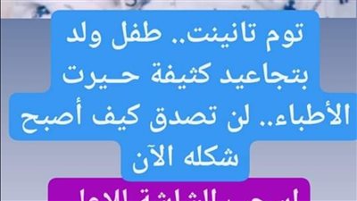 تتوم تانينت.. طفل ولد بتجاعيد كثيفة حـيرت الأطباء.. لن تصدق كيف أصبح شكله الآن